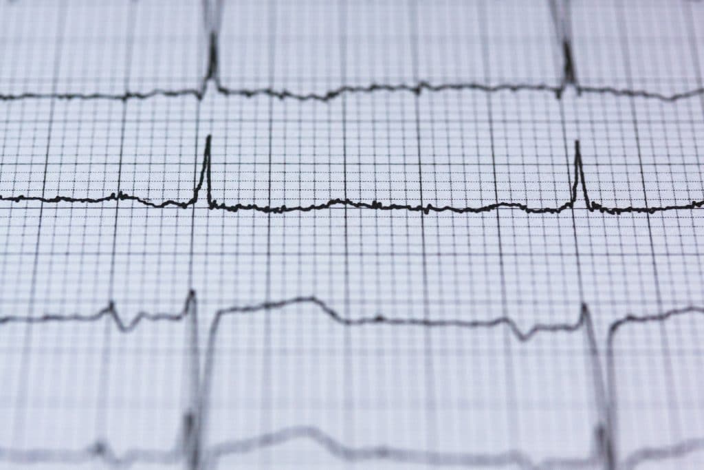 A szívverés ereje: Milyen hatással van testünkre és egészségünkre?