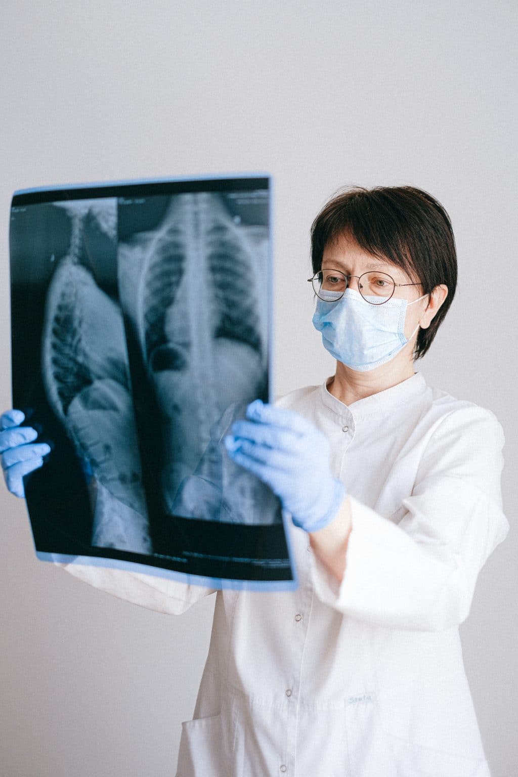 Cisztás fibrózis: Tünetek, diagnózis, kezelés és prognózis